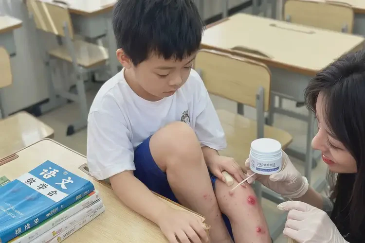 小學(xué)生大腿偶爾長(zhǎng)濕疹能靠自己自愈嗎(圖3)