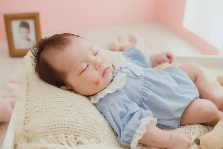 嬰兒手臂上容易長濕疹能徹底自愈嗎(圖2)