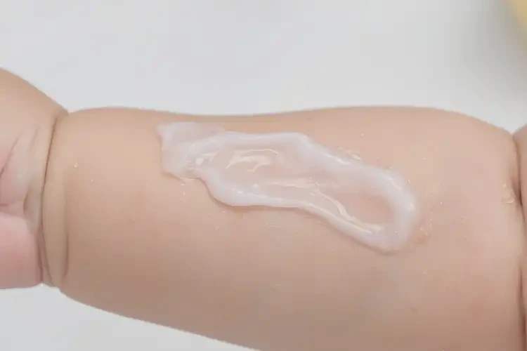 嬰兒手臂上容易長濕疹能徹底自愈嗎(圖3)