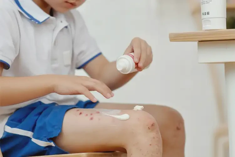 小學(xué)生大腿上起濕疹不管它會(huì)自己自愈嗎(圖2)