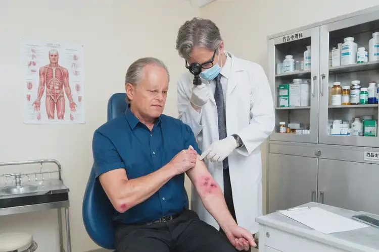 男生全身容易起湿疹可以彻底自愈吗(图3)