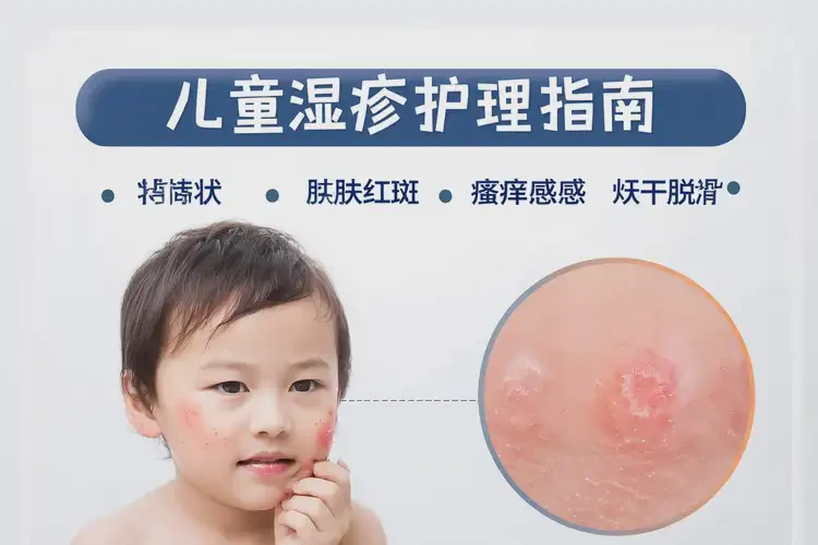 孩子臉上經(jīng)常起濕疹能夠徹底治愈嗎(圖4)