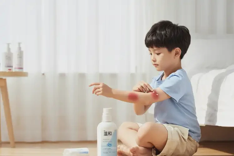 小孩脖子上有濕疹能徹底自愈嗎(圖2)