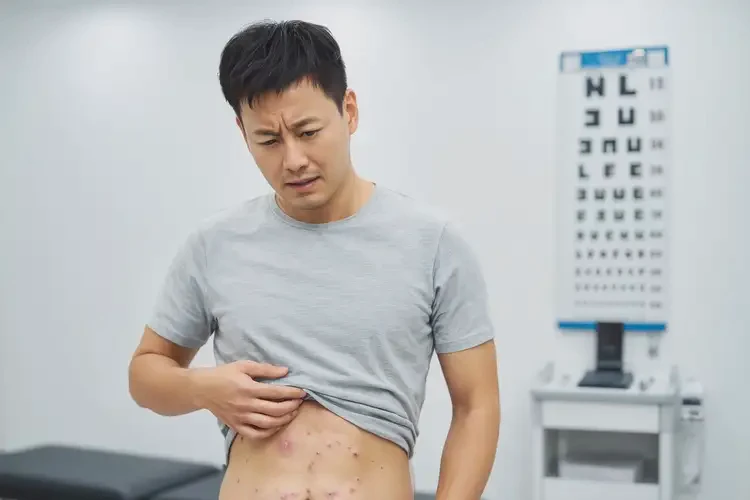 男人肚子偶爾起濕疹不管它會(huì)自己好嗎(圖2)