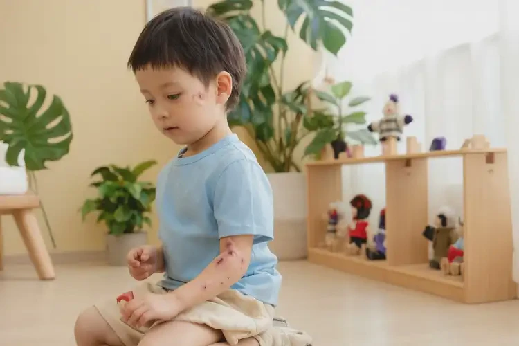 兒童手臂經(jīng)常長濕疹可以徹底自愈嗎(圖2)