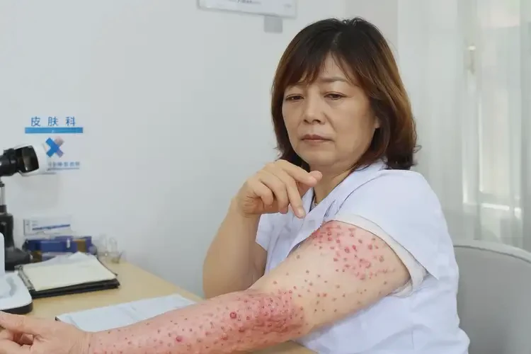 女生肚子上容易起濕疹不管它會自己痊愈嗎(圖4)