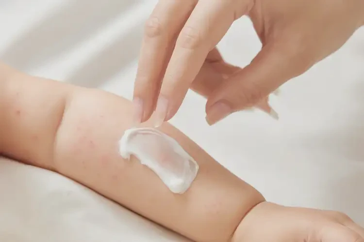 寶寶手臂上起濕疹能靠自己自愈嗎(圖3)