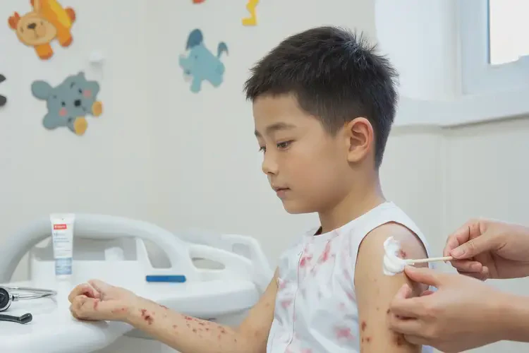 小孩脖子上起濕疹能靠自己自愈嗎(圖3)