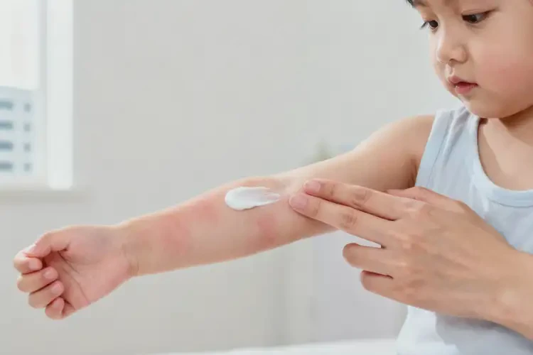 幼兒手臂上容易起濕疹能不能徹底自愈(圖4)