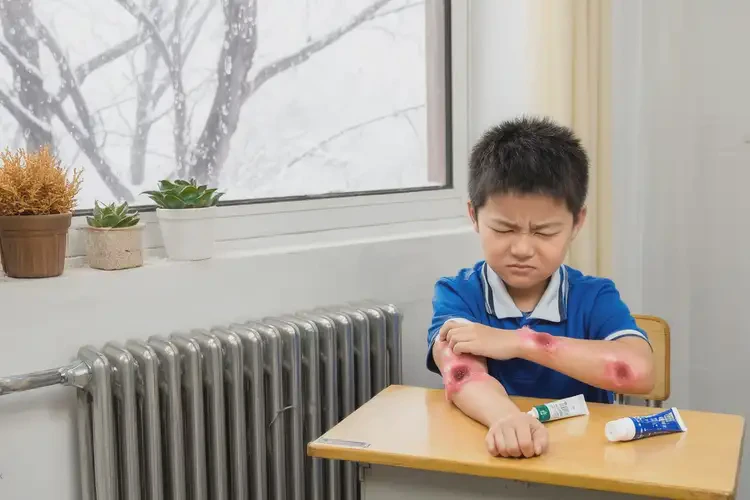 小學(xué)生手臂出濕疹能徹底自愈嗎(圖2)