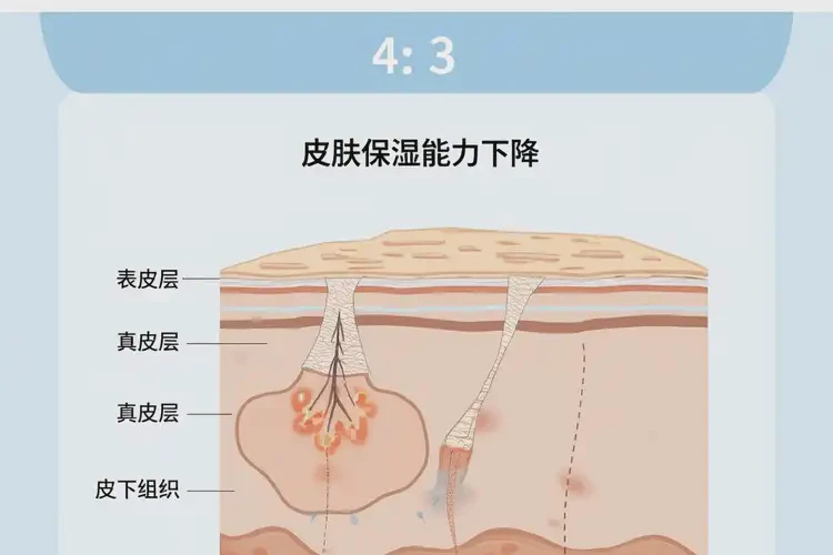 老年人腳上容易起濕疹可不可以徹底自愈(圖4)