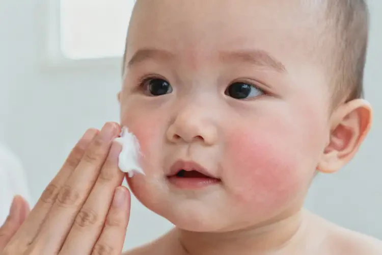 寶寶面部經(jīng)常長濕疹不管它會自己痊愈嗎(圖1)