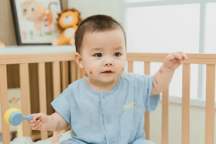 寶寶手臂上經(jīng)常長(zhǎng)濕疹可不可以徹底自愈(圖1)