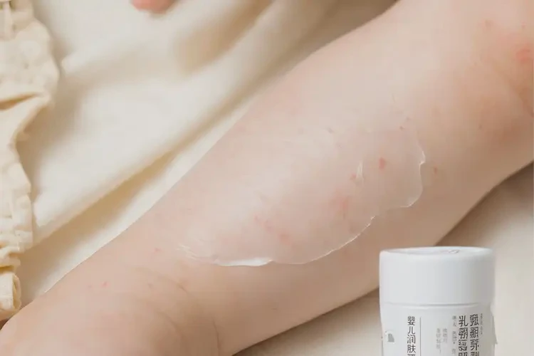 嬰幼兒小腿上偶爾起濕疹能夠徹底治愈嗎(圖3)