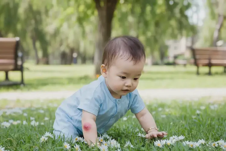 婴幼儿手臂容易长湿疹能彻底自愈吗(图2)