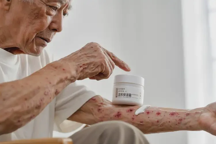 老年人手臂上起湿疹可以彻底自愈吗(图3)