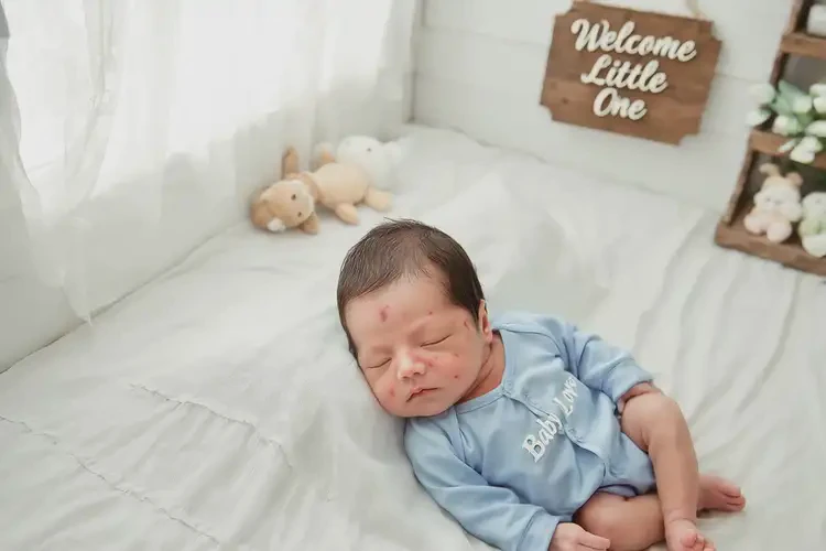 新生儿脖子上出湿疹不管它会自己自愈吗(图3)