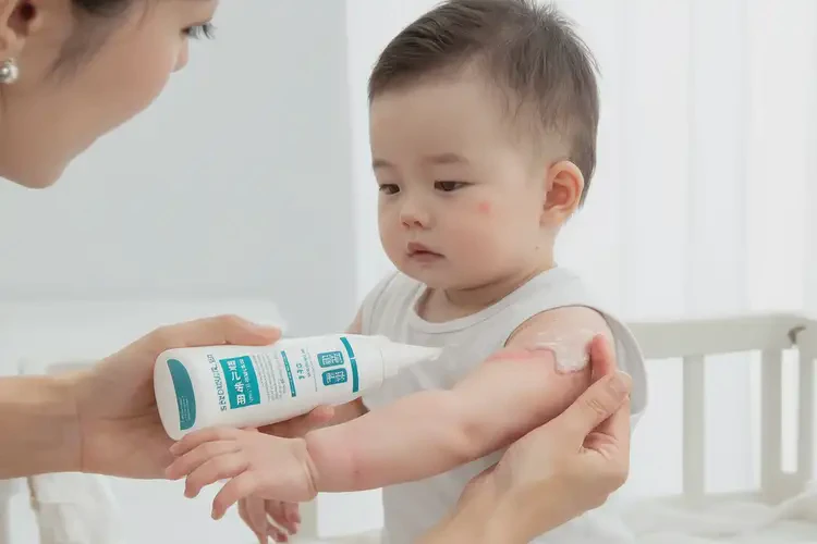 寶寶手臂上經(jīng)常起濕疹能靠自己自愈嗎(圖3)