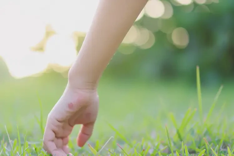 女生手臂上经常长湿疹能靠自己自愈吗(图4)