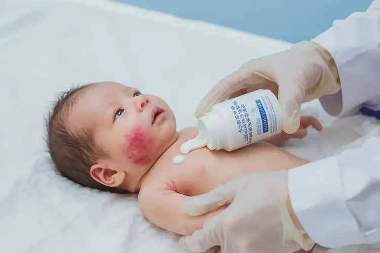 婴儿脖子上出湿疹不管它会自己痊愈吗(图2)