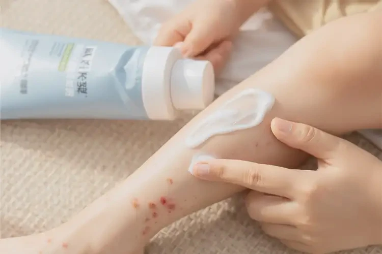 孩子小腿容易長濕疹可以徹底自愈嗎(圖1)