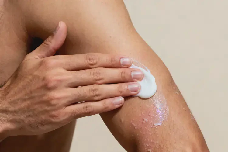 男生全身容易長濕疹可不可以徹底自愈(圖1)