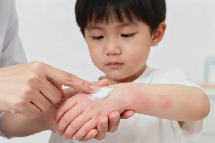 少兒手上有濕疹不管它會(huì)自己好嗎(圖1)