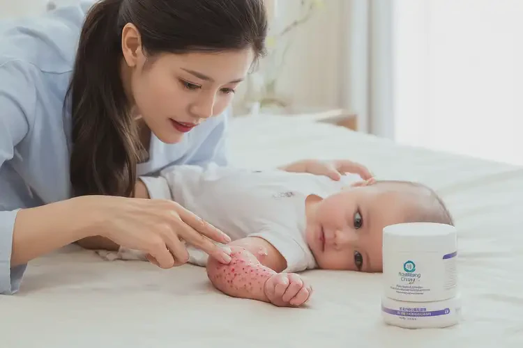 婴儿手臂经常长湿疹能靠自己自愈吗(图3)