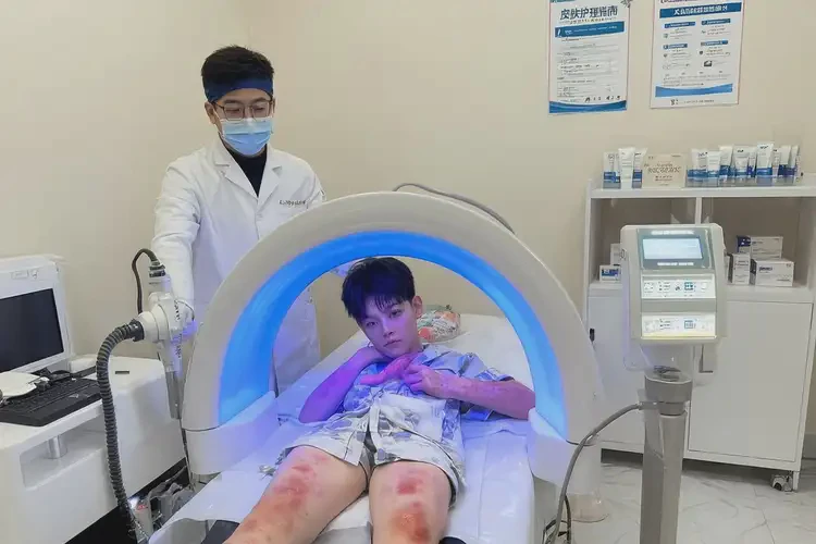 女人臉上出濕疹不管它會(huì)自己自愈嗎(圖1)