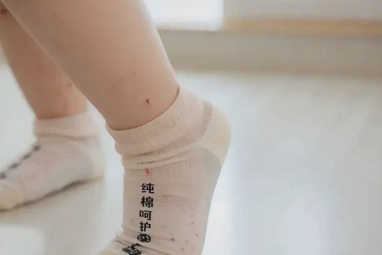 孩子腳上有濕疹可以徹底自愈嗎(圖3)