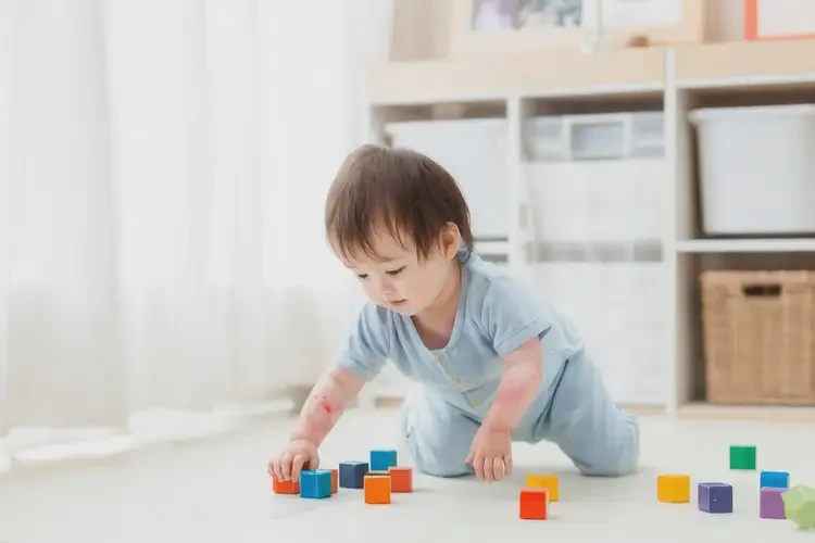 幼兒手臂長濕疹不管它會自己自愈嗎(圖3)