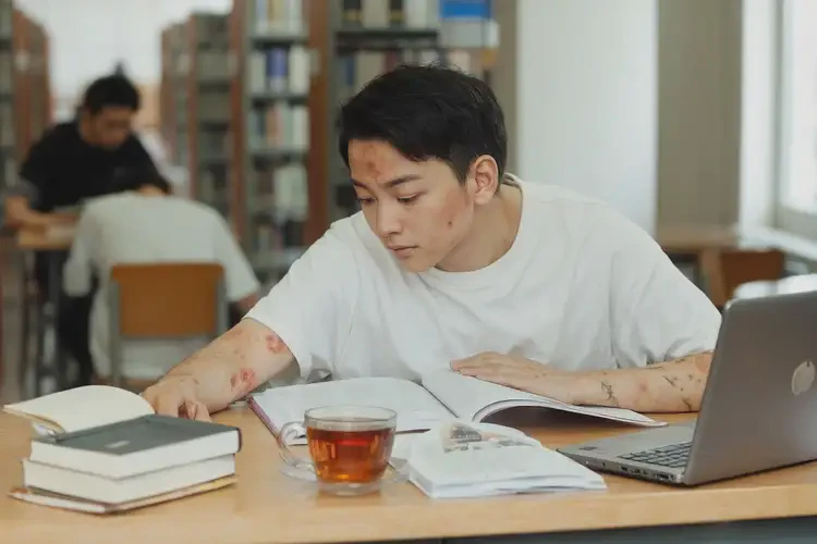 大學(xué)生身上容易起濕疹能不能徹底自愈(圖4)