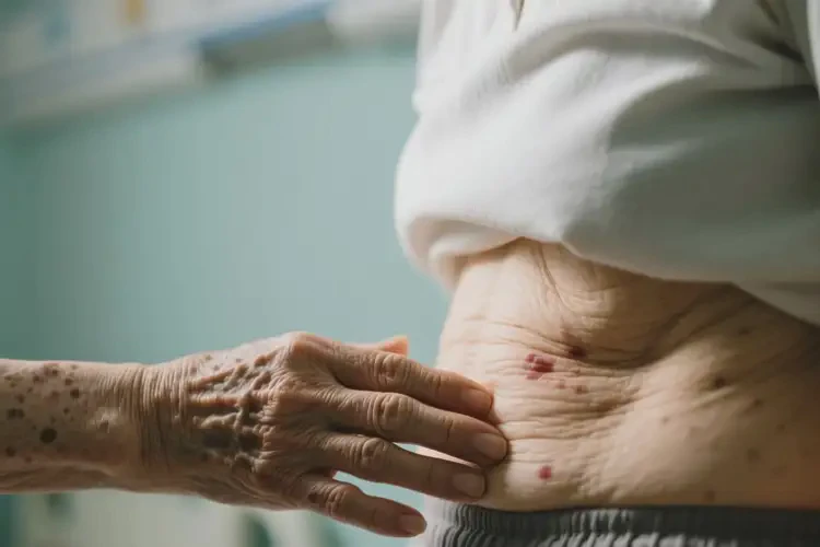 老年人肚子容易起湿疹不管它会自己自愈吗(图1)