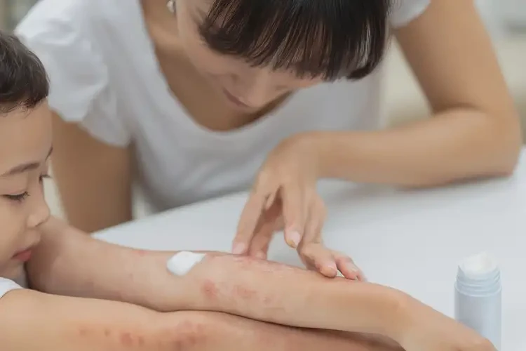 儿童手臂上经常长湿疹不管它会自己好吗(图3)