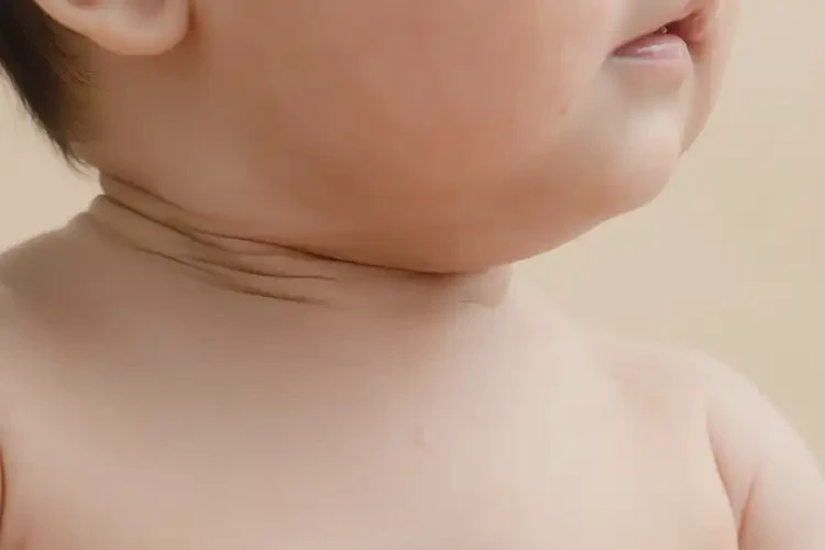 宝宝脖子有湿疹能靠自己自愈吗(图2)