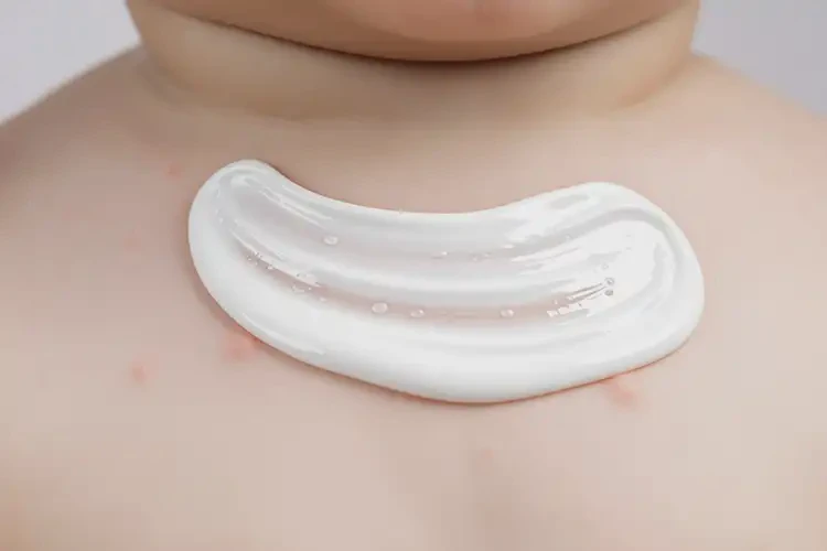 幼兒脖子偶爾長濕疹不管它會自己自愈嗎(圖2)