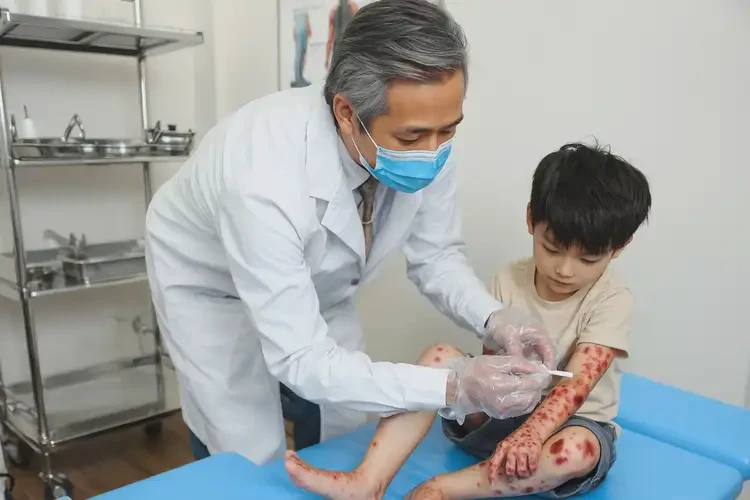 少儿四肢出湿疹能够彻底治愈吗(图3)