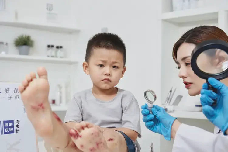 小兒四肢偶爾長濕疹不管它會自己自愈嗎(圖4)