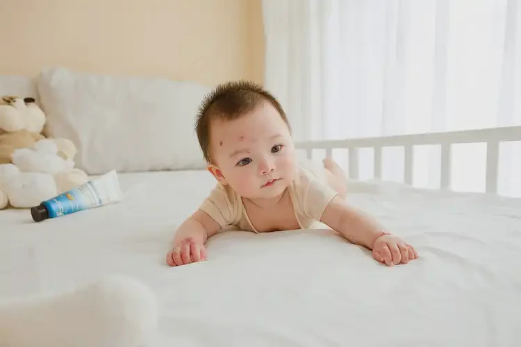 嬰幼兒四肢偶爾起濕疹不管它會自己好嗎(圖3)