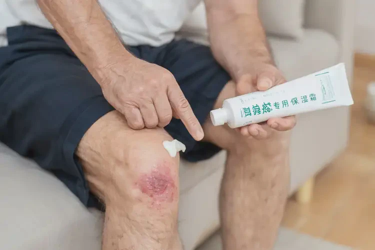 男性大腿上起濕疹能徹底自愈嗎(圖3)