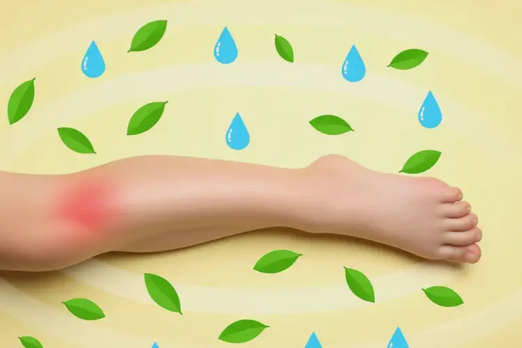 小学生大腿起湿疹能够彻底治愈吗(图3)