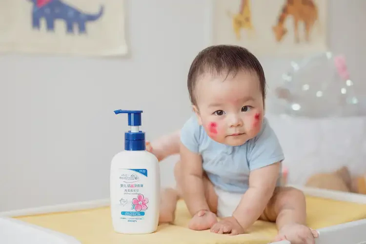 小兒屁股上長濕疹能徹底自愈嗎(圖4)