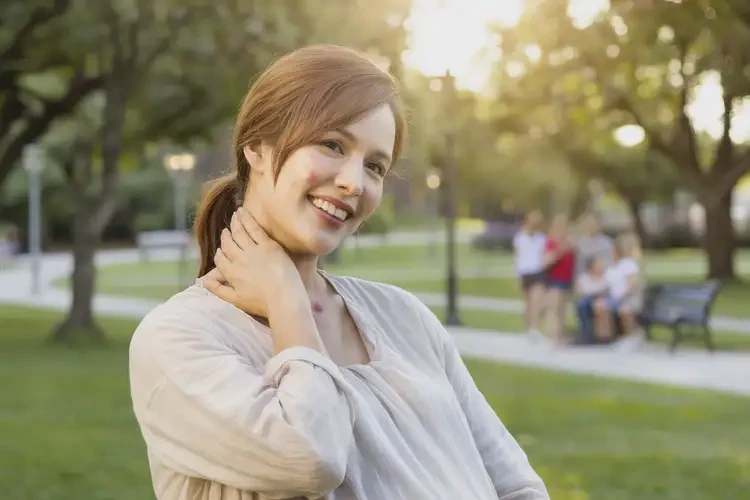 哺乳期媽媽脖子上有濕疹能徹底自愈嗎(圖2)