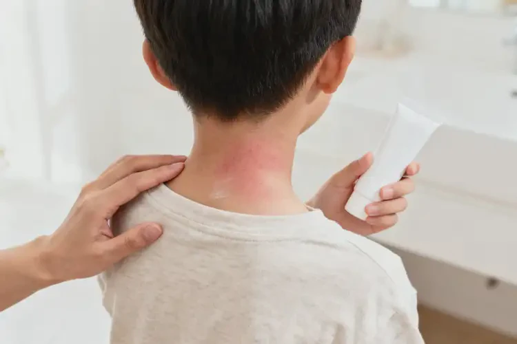 小學(xué)生脖子上出濕疹可不可以徹底自愈(圖4)