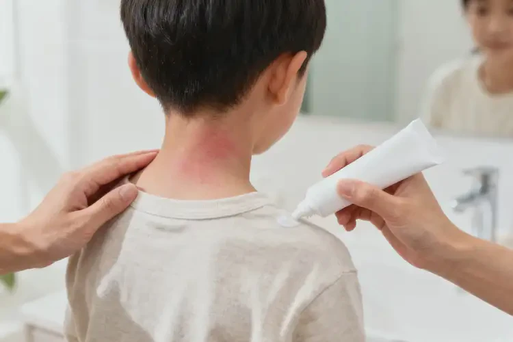 小學(xué)生脖子上出濕疹可不可以徹底自愈(圖2)