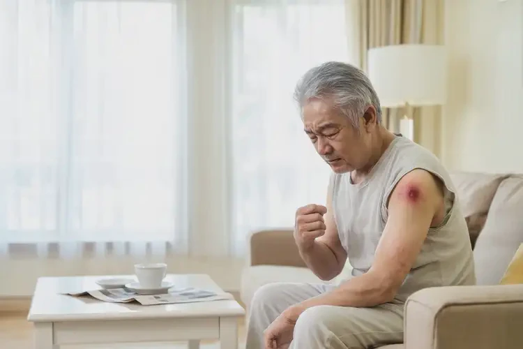 老人四肢偶爾起濕疹不管它會(huì)自己好嗎(圖4)