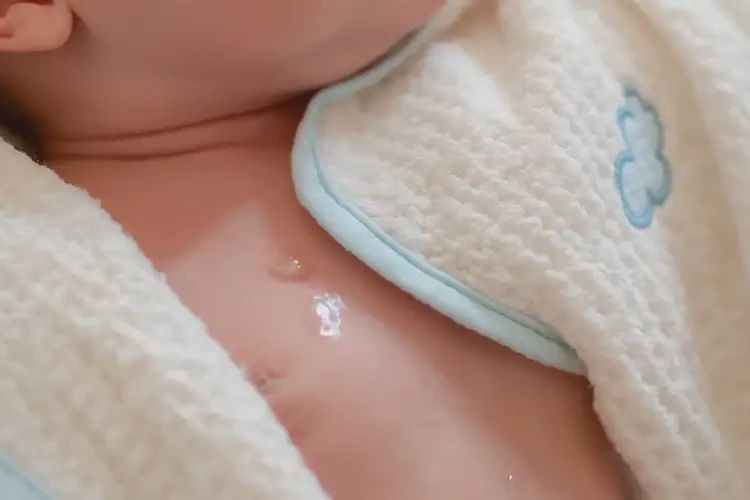 新生兒脖子容易長濕疹能靠自己自愈嗎(圖3)