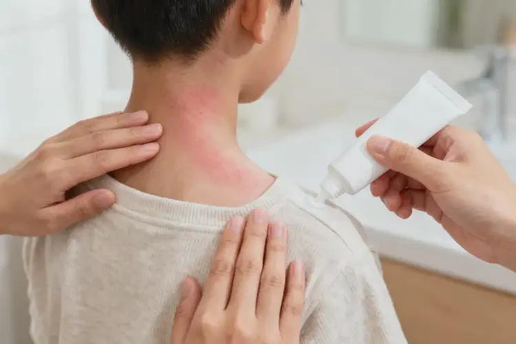 小學(xué)生脖子上出濕疹可不可以徹底自愈(圖1)