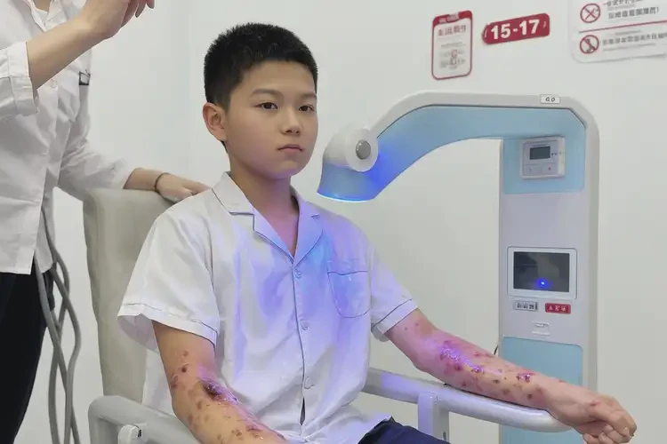 小兒大腿上經(jīng)常長(zhǎng)濕疹不管它會(huì)自己痊愈嗎(圖1)