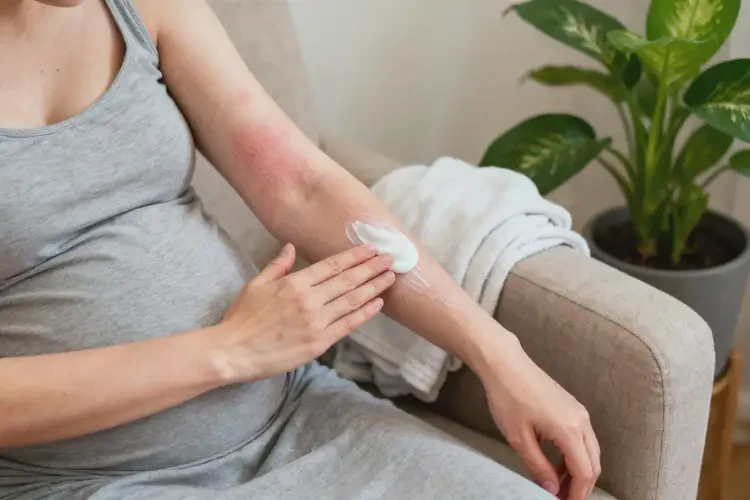 产妇手臂容易长湿疹不管它会自己自愈吗(图3)